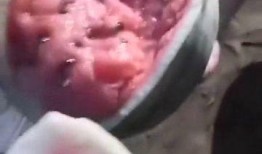 药流后可以吃沙白瓜吗